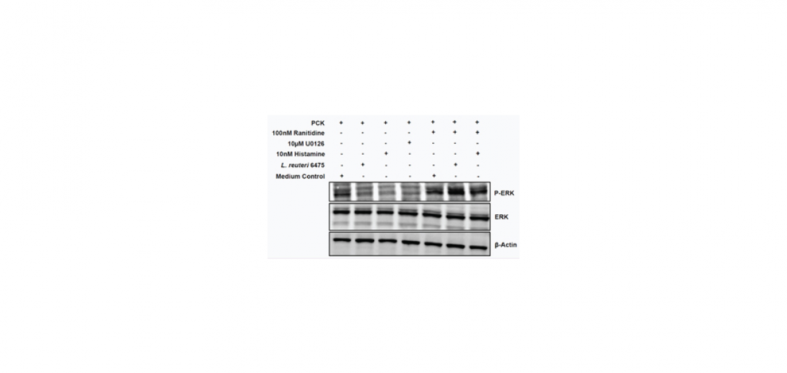 Histamine Produced by L. reuteri Inhibits the ERK Signaling Pathway