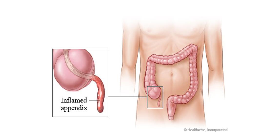 Appendix