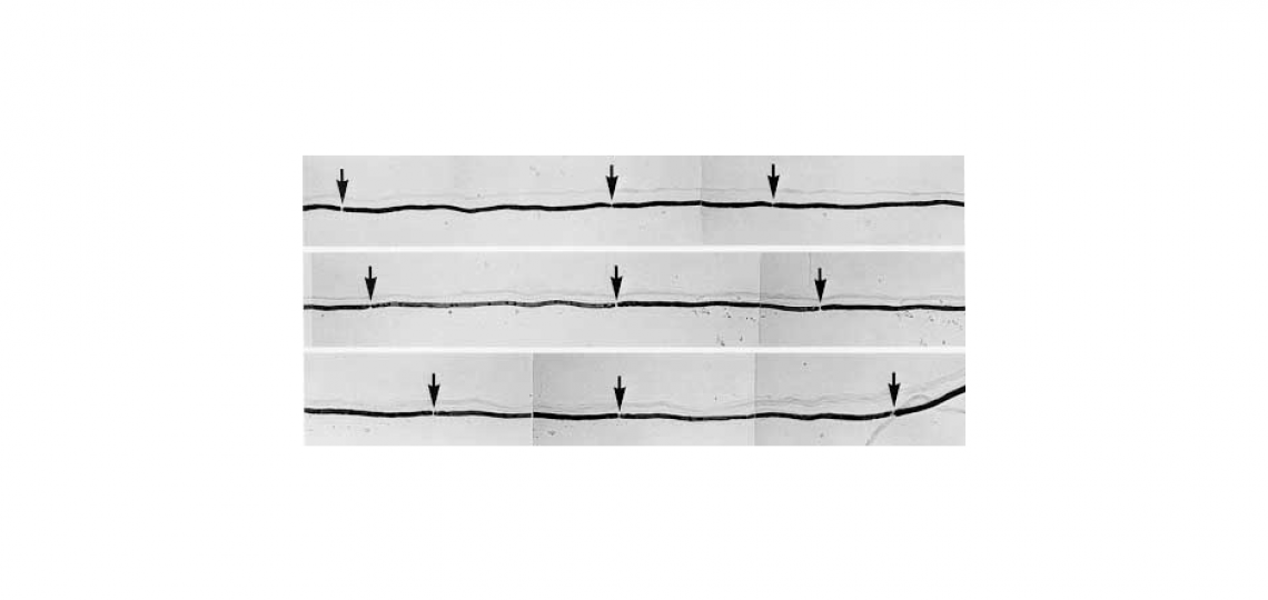 Nerve Biopsy fibers