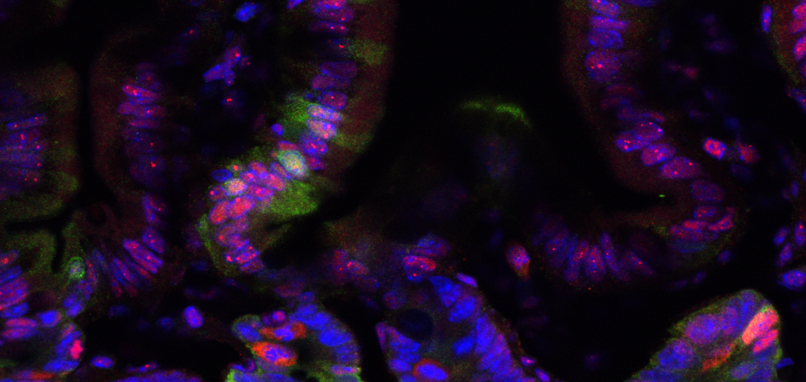 Intestinal stem cells
