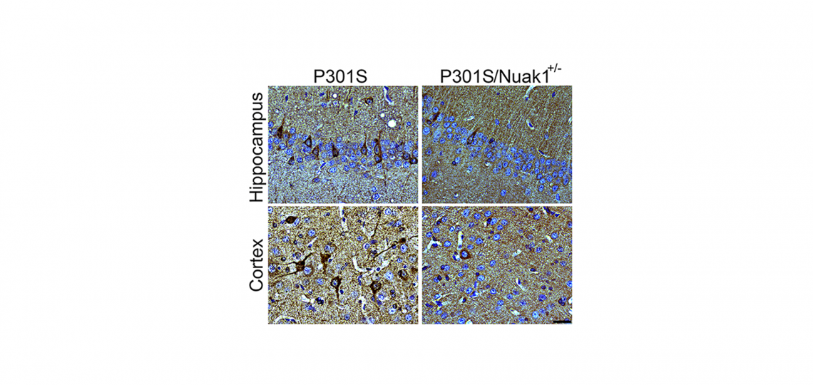Brain section from mouse carrying the dementia-causing P301S mutation in human tau shows accumulation of tau neurofibrillary tangles (in dark brown, left). When Nuak1 levels are decreased by 50% (P301S/Nuak1+/-; right), fewer tau tangles accumulate.