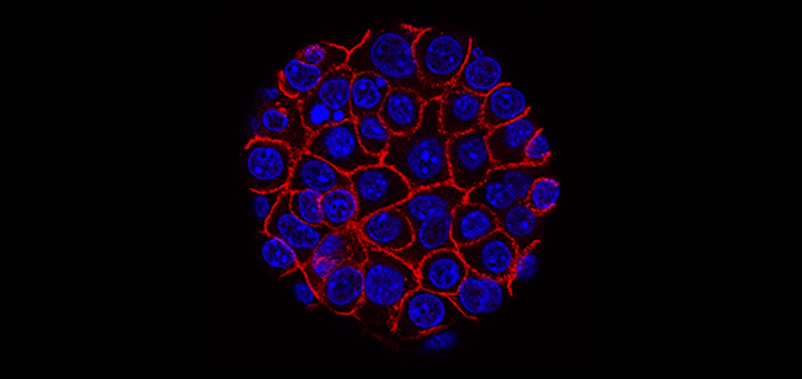 Pancreatic cancer cells (nuclei in blue) growing as a sphere encased in membranes (red). Courtesy of the National Cancer Institute