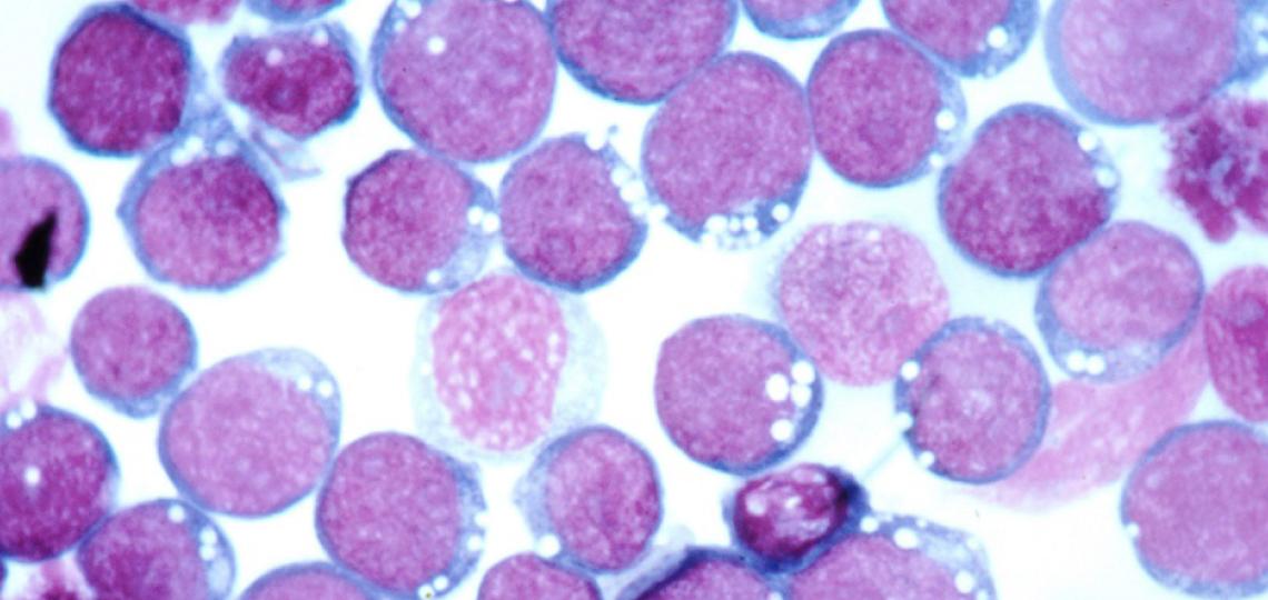 Smaller Epstein-Barr Virus