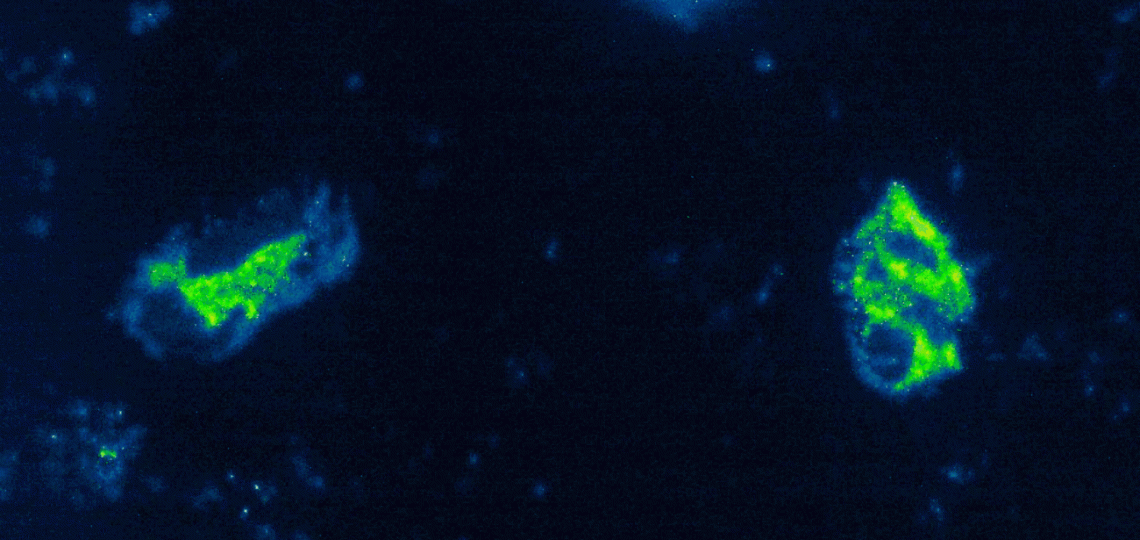 The image shows 2 neutrophils that are firmly adhered and spreading over platelet monolayers while under shear stress. The neutrophil (and platelet) granules are labeled with mepacrine (green). The remainder of the image is pseudocolored.
