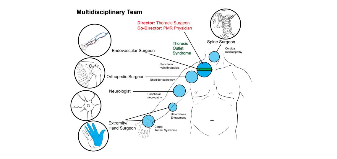 Multidisciplinary TOS team.