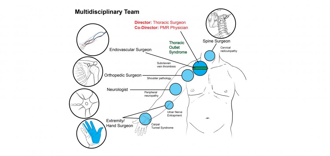 Multidisciplinary TOS team.