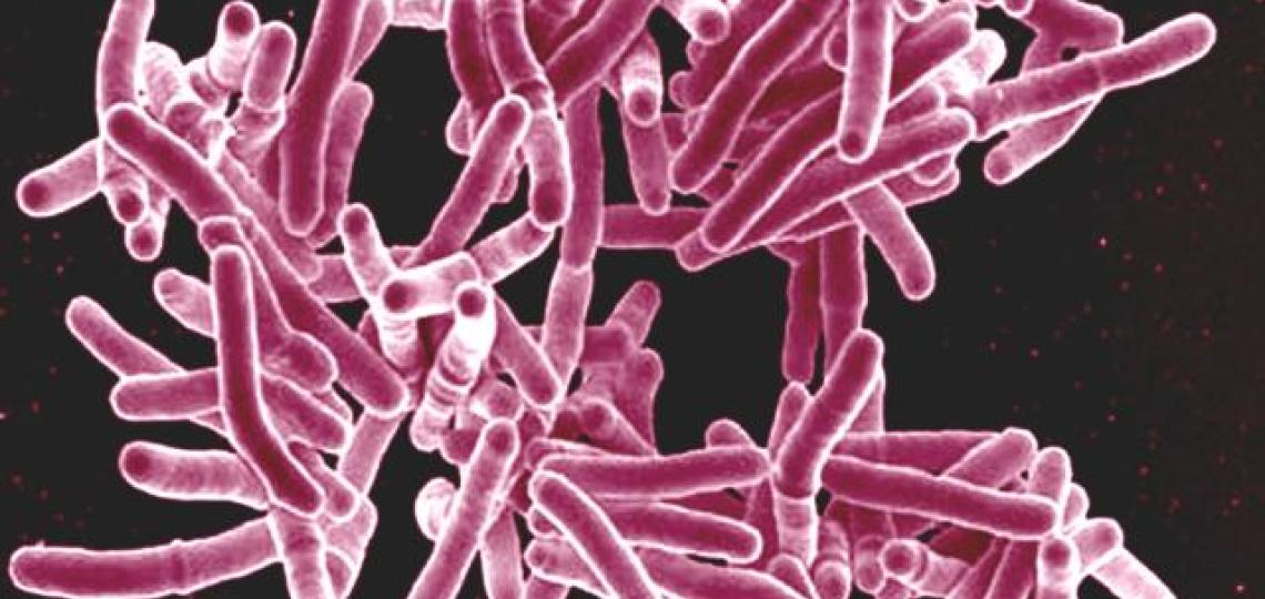 Scanning electron micrograph of Mycobacterium tuberculosis bacteria, which cause TB.