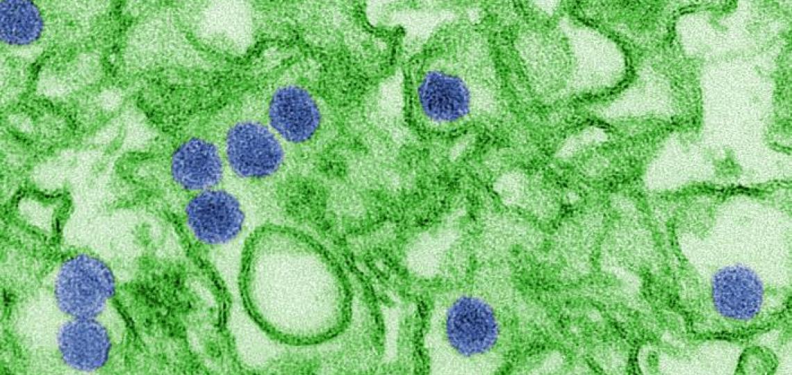 A digitally-colorized transmission electron micrograph (TEM) of Zika virus. Virus particles (colored in blue), are 40 nm in diameter, with an outer envelope, and an inner dense core.