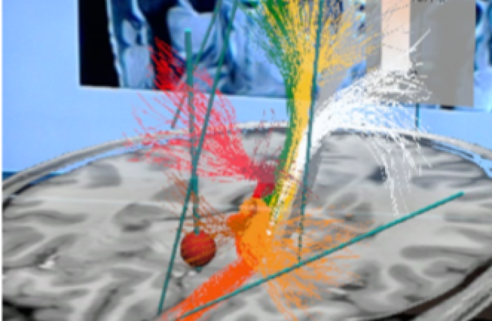 Translating electrophysiology to stimulation Imaging Tools