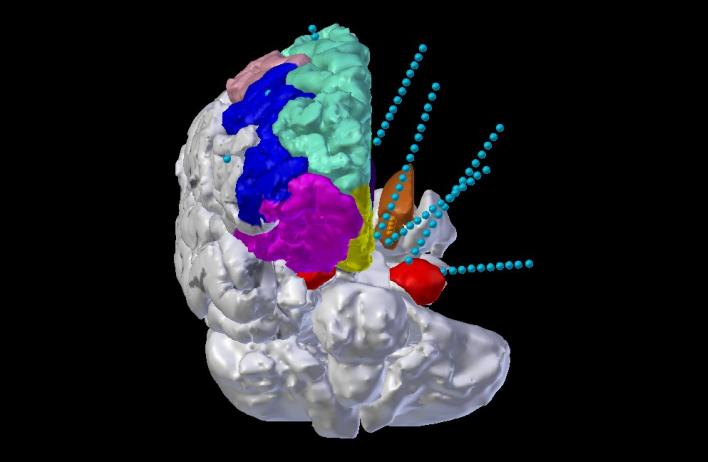 Translating electrophysiology to stimulation Imaging Tools