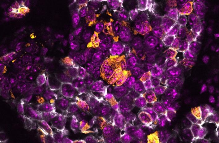 Fluorescent imaging of a basal-like TNBC tumor model
