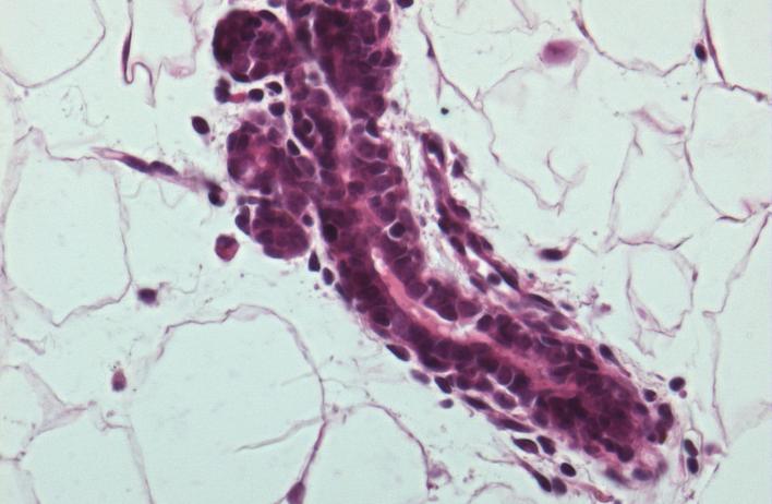 H&amp;E staining of the epithelial bilayer of the mammary gland