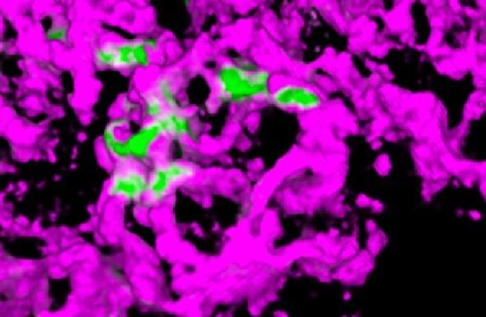Tumor cells (green) interacting with the lung vasculature (magenta) during metastatic seeding in the lung