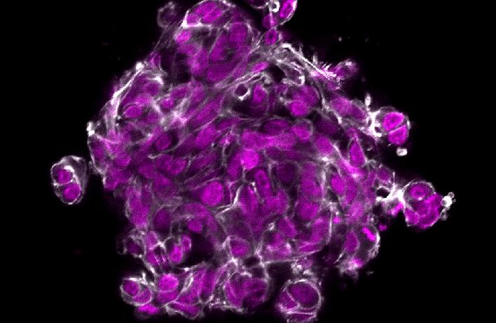F-actin (white) organization within a tumor organoid