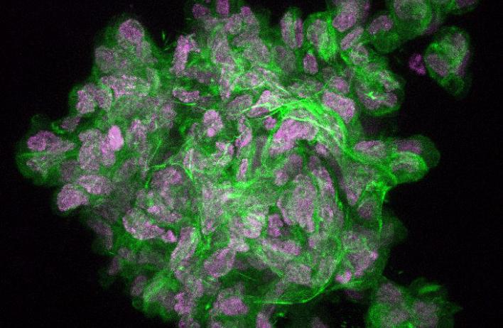 Phalloidin staining of F-actin within a breast tumor organoid