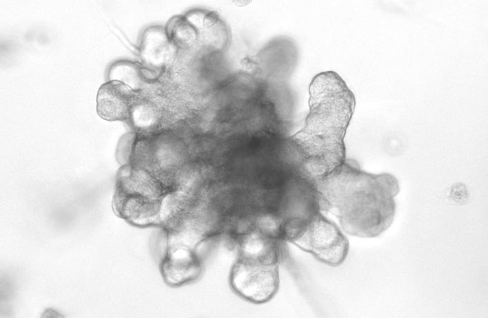 Mammary organoid undergoing branching morphogenesis