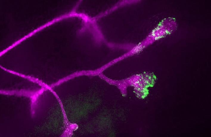 Fluorescent imaging of the mammary terminal end bud during puberty