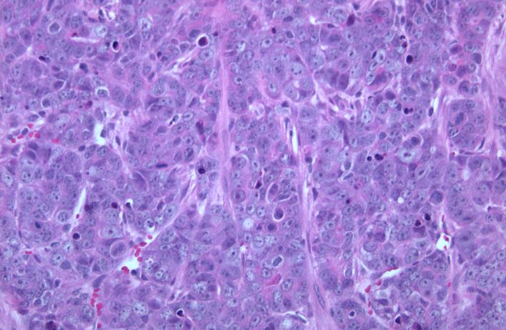 H&amp;E staining of a TP53-null mammary tumor