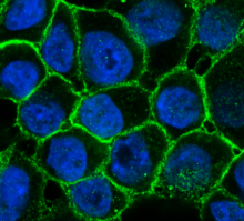 Human breast epithelial cells 
