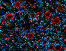 Cells in the cerebellar nuclei (red) surrounded by Purkinje cell projections (blue) that express GFP-fused channel rhodopsin (green).