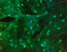 Cells from normal uterus.