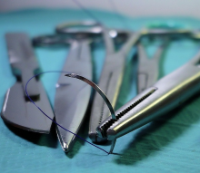 surgery-stitch-photo