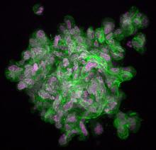 Organoid F Actin