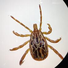 a zoomed-in photo of a tick