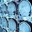 Brain scans