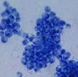 Yeast Candida Albicans