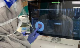 Researchers examine breast tissue removed during a lumpectomy using the OTIS ImgAssist technology. 