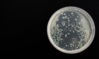 Bacteria