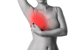 Photo of a woman giving herself a breast exam. 