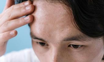 Close up photo of a man's forehead sweating