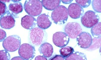 Smaller Epstein-Barr Virus