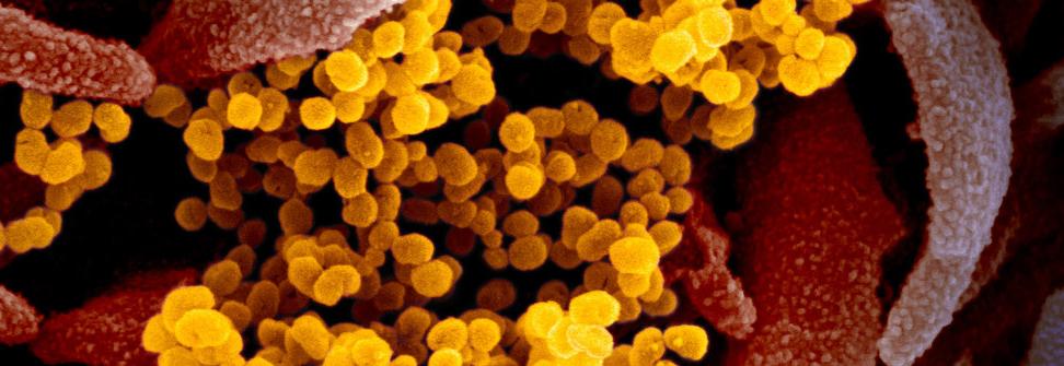 Coronavirus Preparedness