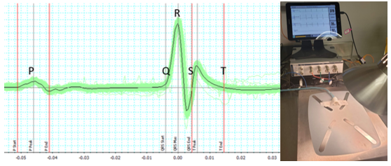 Conscious via ECGenie