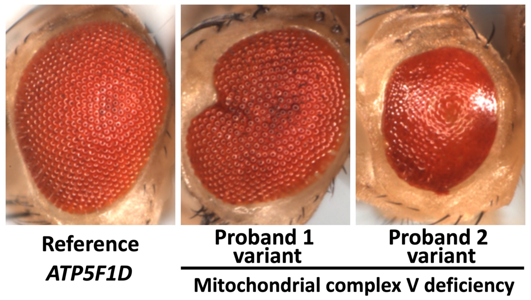Recessive missense variants in ATP5F1D