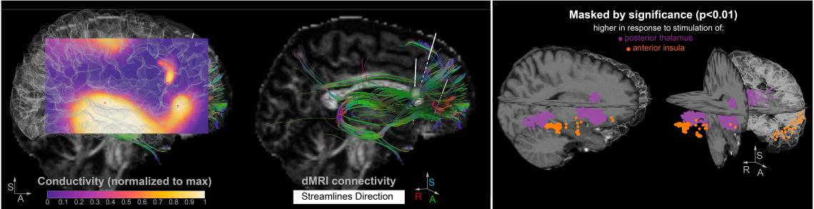 Brain scans