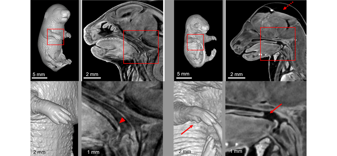 A precision mouse model verified the pathogenicity of a p.E66K variant in AXIN2