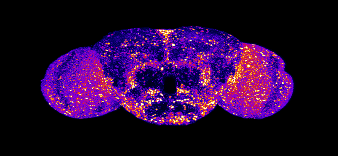Precision fruit fly (Drosophila) models, in which expression of the endogenous fly Uba5 gene is replaced by human UBA5 cDNA, classified 12 developmental and epileptic encephalopathy 44 (DEE44)-associated variants as causing mild, intermediate, or severe loss of function