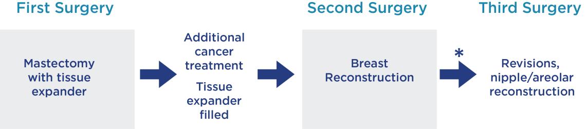 Timeline of delayed breast reconstruction surgery: First surgery, mastectomy with tissue expander. Then additional cancer treatment and tissue expander filled. Second surgery, breast reconstruction. Third surgery, revisions, nipple/areolar reconstruction.