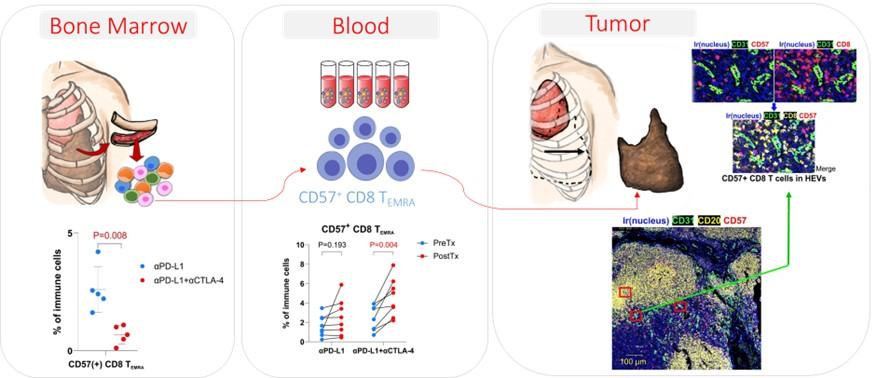 Single-cell multi-omics integration to exploit autoimmunity induced by checkpoint immunotherapy in malignant pleural mesothelioma