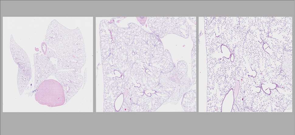 Digital imaging of stained slides