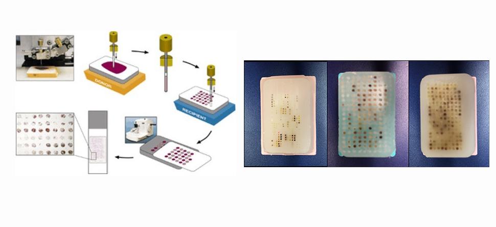 TMAs using human or animal model tissues