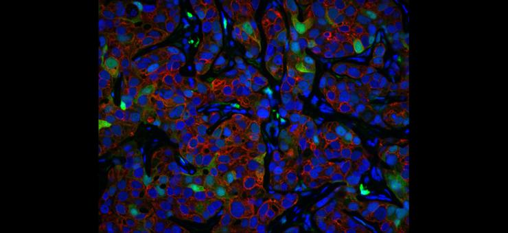 co-immunofluorescence-PDX