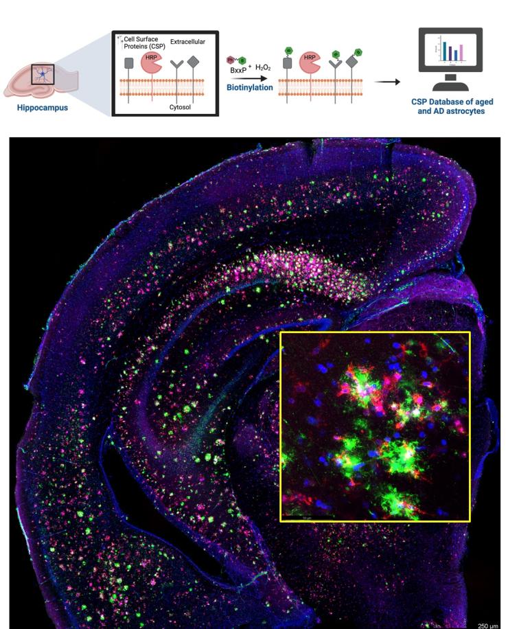 Microglia CSP with Abeta plaques