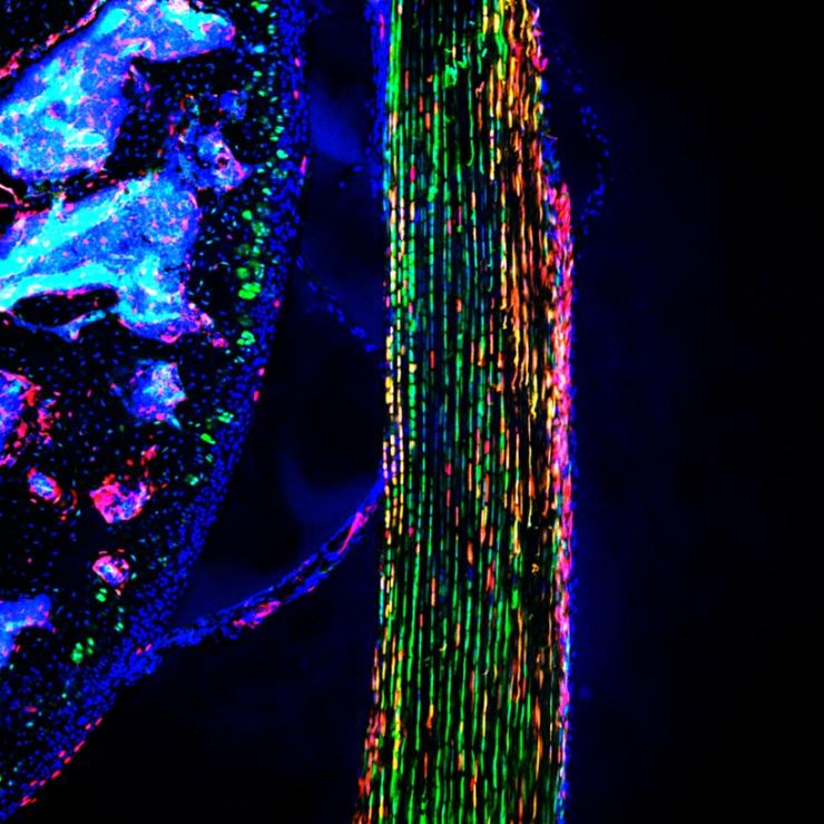 photo of periosteal skeletal stem cells