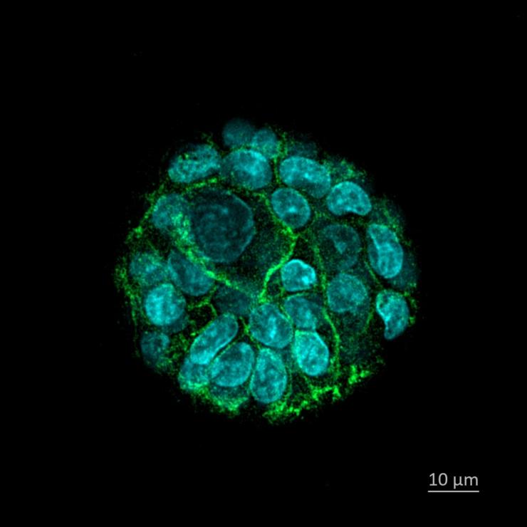 green and blue bladder organoid