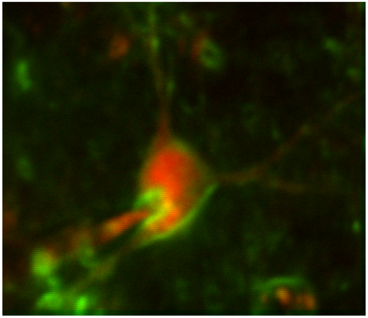 two-photon imaging and in vivo whole-cell patching